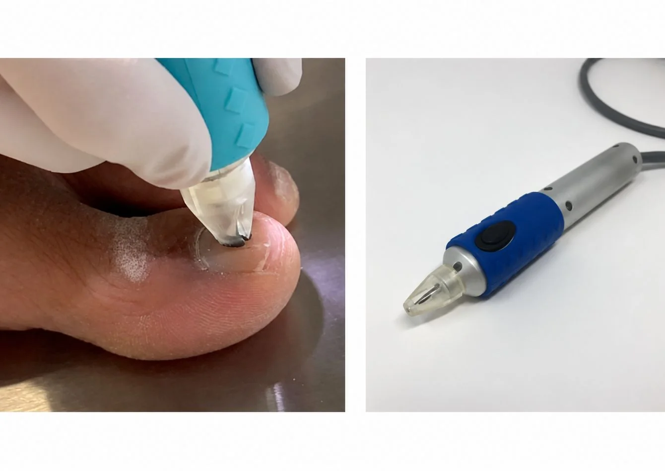 FDA-Cleared Medical Device Platform with Patented… — Sale in Boston, MA, photo 1 of 1